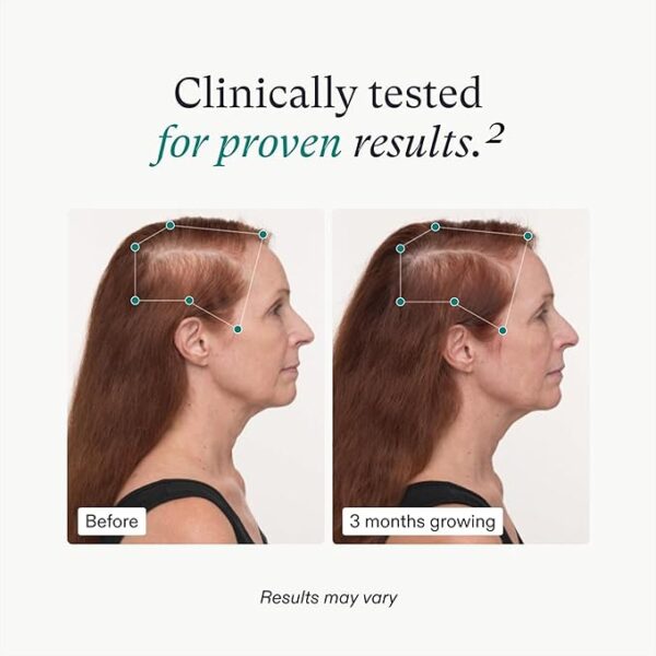 Nutrafol Women's Balance Hair Growth Supplements, Ages 45 and Up - Image 3